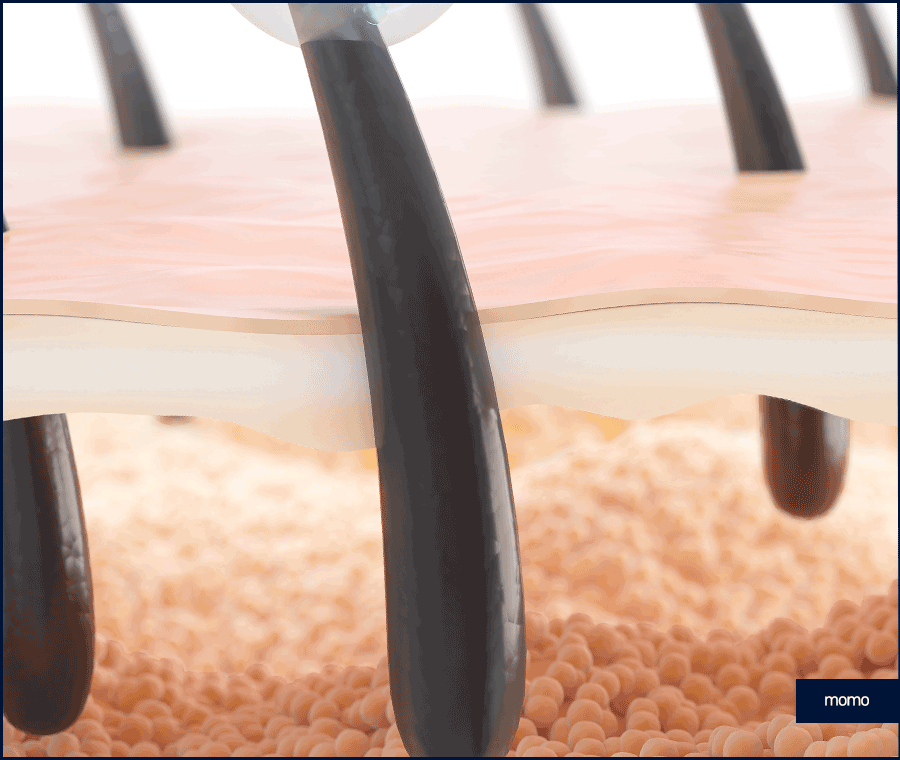 강남 탈모 병원 원인 파악부터 철저하게 시작하는 곳 관련 이미지 6