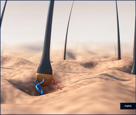 모발이식 후기 비교하며 섬세한 분석까지 해야만 관련 이미지 5