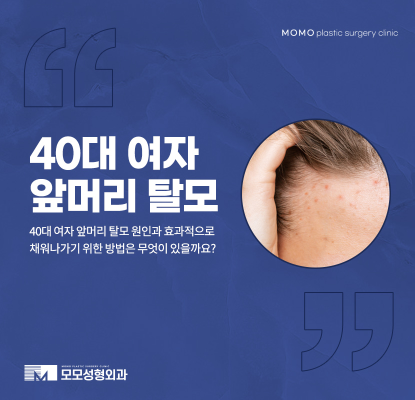 40대여자앞머리탈모 보강이 필요한 이유에 대해 관련 이미지 1