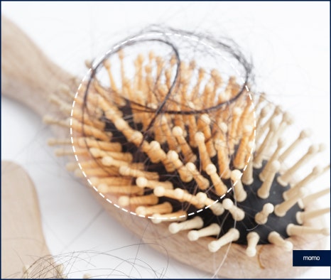 압구정 모발이식 외모 변화를 희망한다면 관련 이미지 9