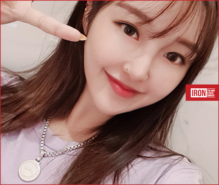 압구정눈성형 알맞은 밸런스로 관련 이미지 3