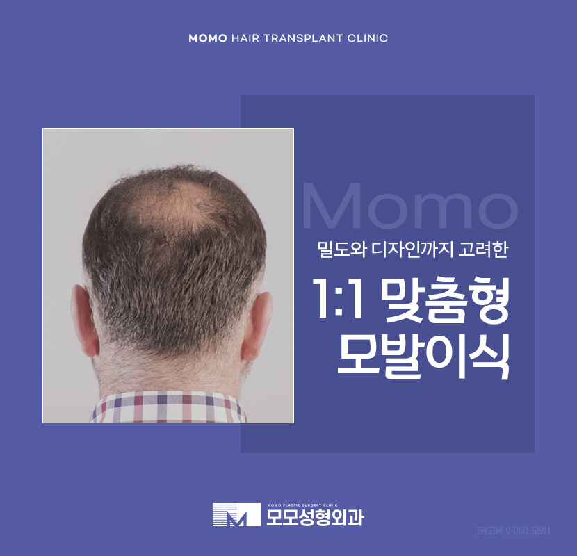 모발이식잘하는곳 찾는 결정적인 기준 관련 이미지 1