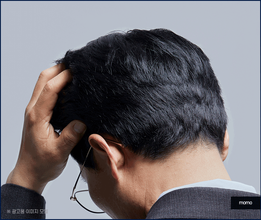 비절개 모발이식 후기와 함께 꼭 알아볼 이것! 관련 이미지 3