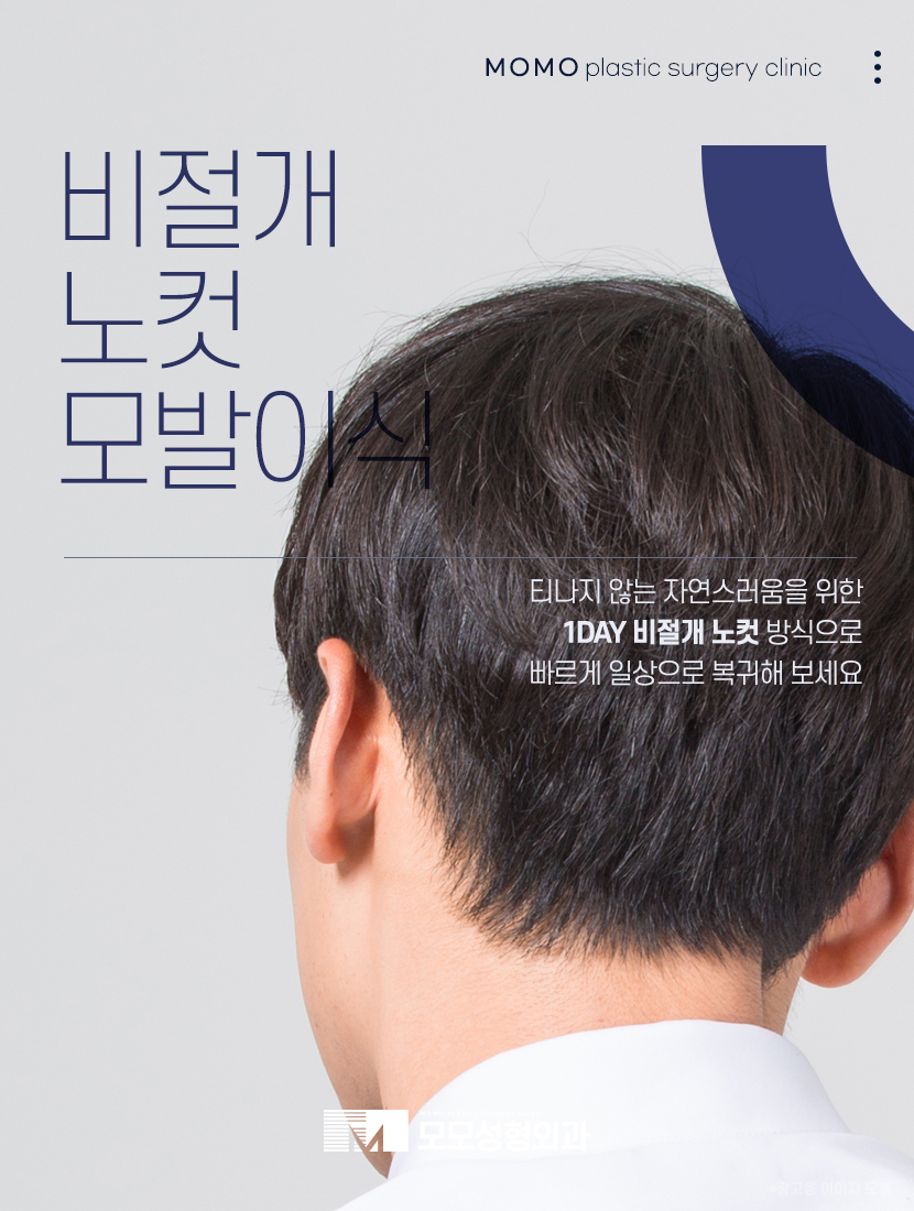 헤어라인교정후기 특성을 고려해서 관련 이미지 9