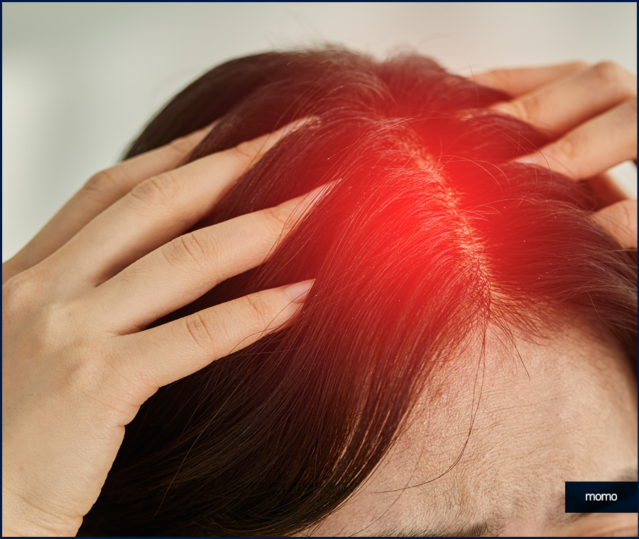 두피 누르면 통증이 느껴질 경우 위험한 이유 관련 이미지 2