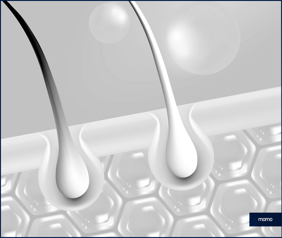 엠자 탈모 섬세하게 채워 만드는 변화 관련 이미지 3