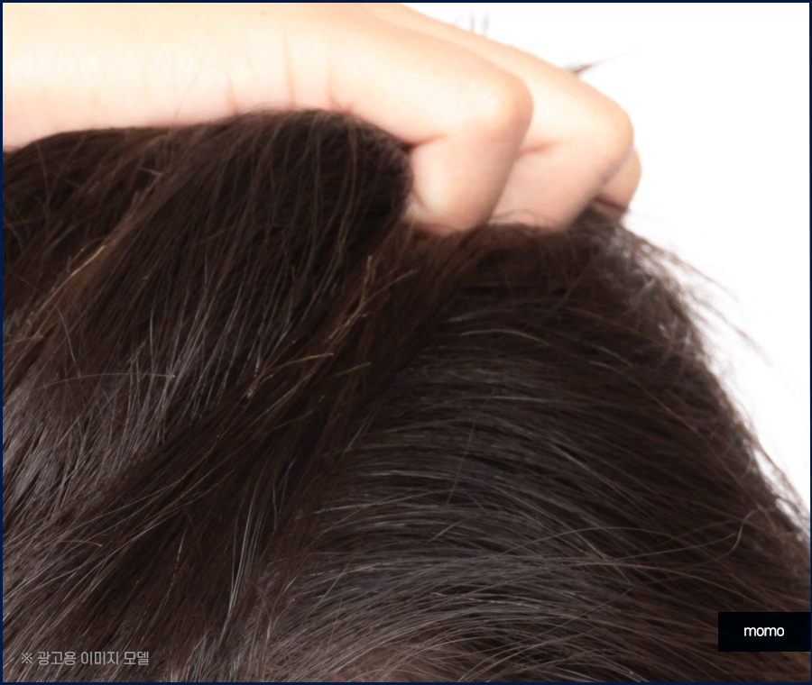 머리 간지러움 원인과 빠른 증상 해소를 위한 tip 관련 이미지 8