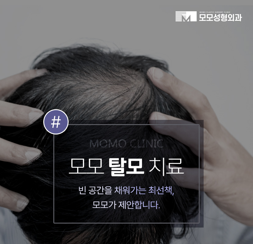 압구정 탈모병원 보완을 위한 최선책은? 관련 이미지 1