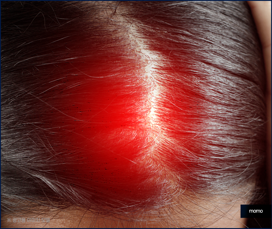 정수리 냄새 원인과 제거하기 위한 방법은 관련 이미지 8