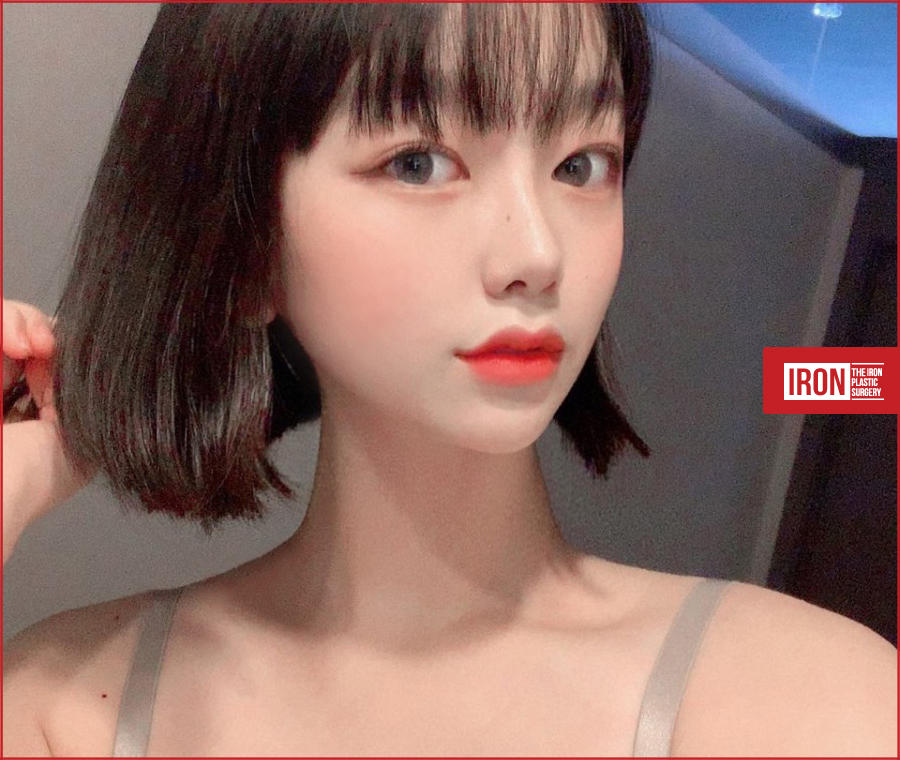 쌍꺼풀아웃라인 화려한 변신을 통해 관련 이미지 4