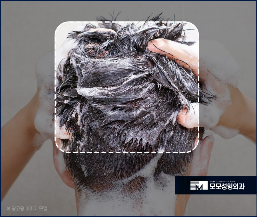 우습게 여기지 말아야 할 헤어라인 뾰루지 관련 이미지 8