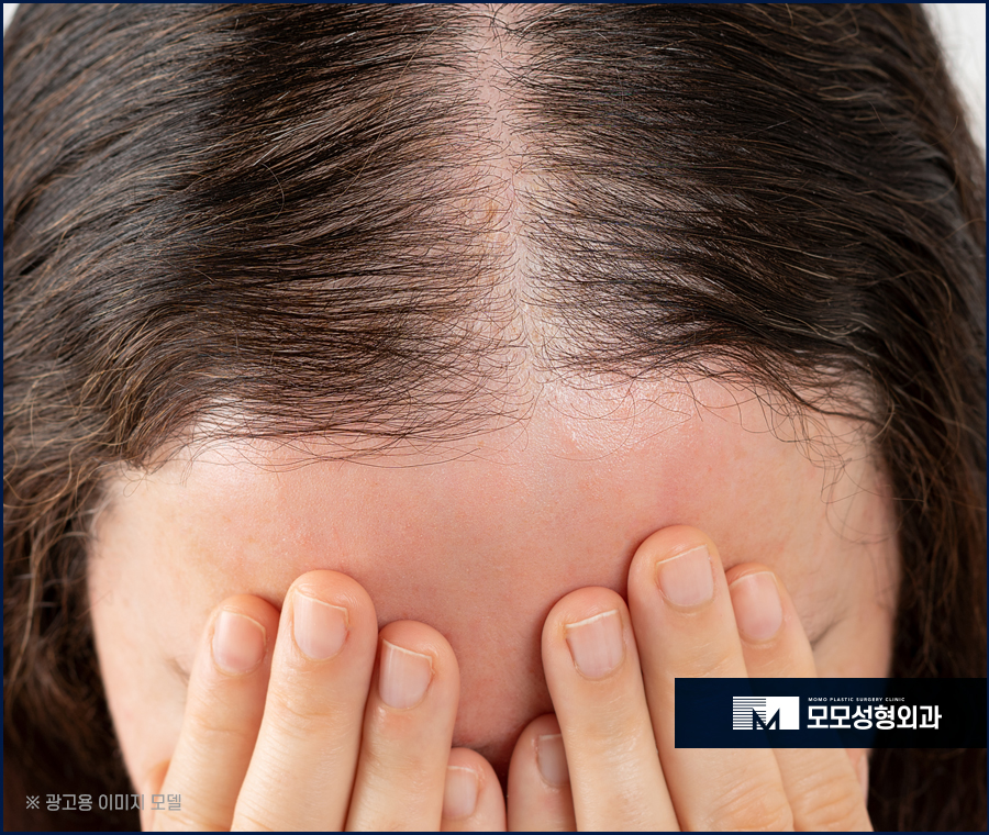 여자앞머리탈모 맞춤 진단으로 채우는 관련 이미지 3