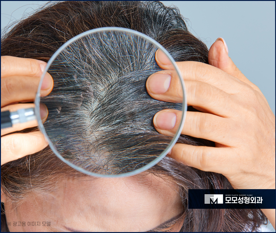 새치염색주기 무리를 주지 않는 선은 관련 이미지 6