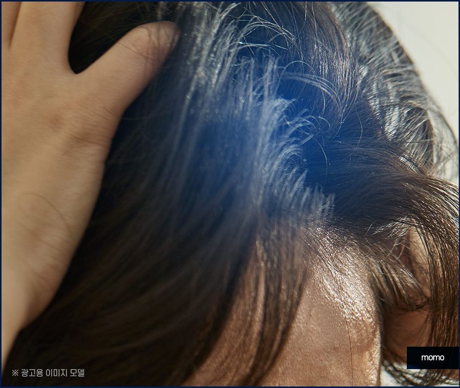 두피가 아파요 증상 원인과 해결하는 방안은 관련 이미지 6