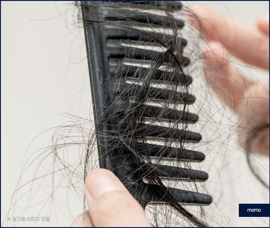 절개모발이식 차이점을 알고 정해야만 관련 이미지 2