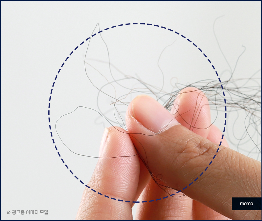 머리심기비용이 달라지는 이유와 차이점 관련 이미지 4