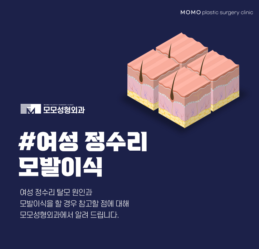 여성 정수리 모발이식 섬세한 집도가 중요한 이유 관련 이미지 1