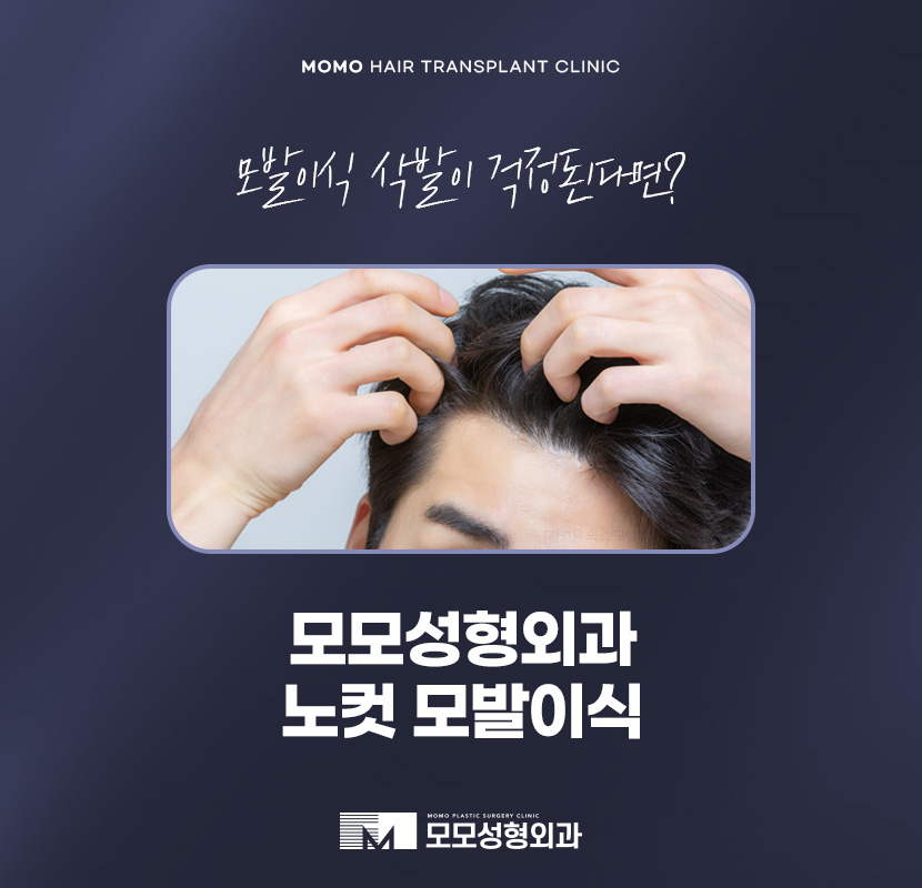 모발이식 삭발이 싫다면 노컷으로 부담을 줄여서 관련 이미지 1
