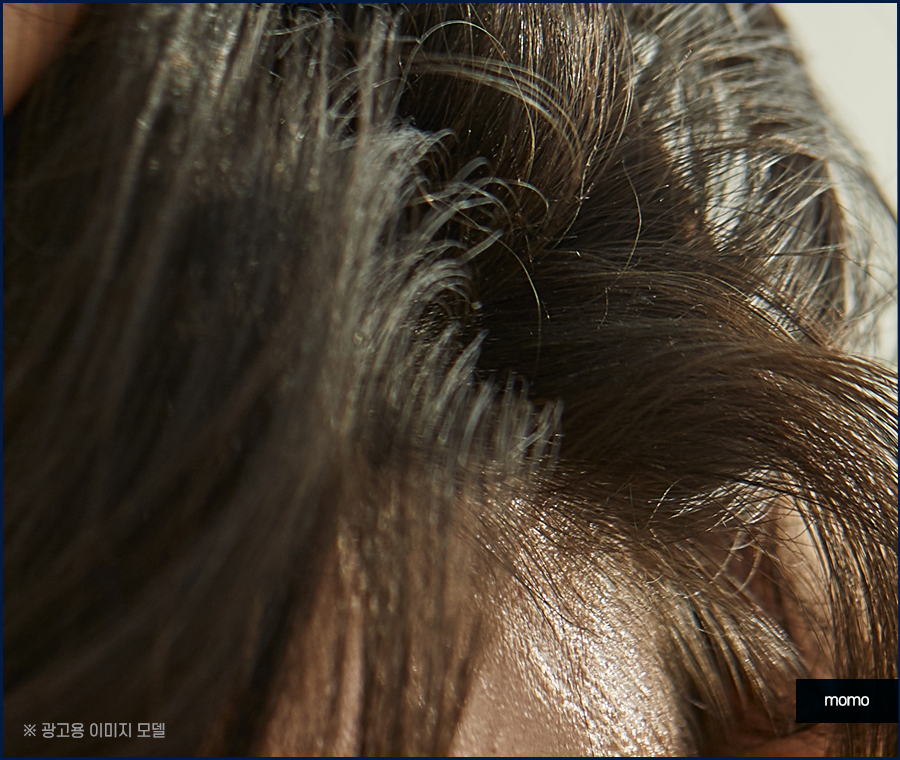 머리비듬없애는법 효과적인 비결에 대해 관련 이미지 9