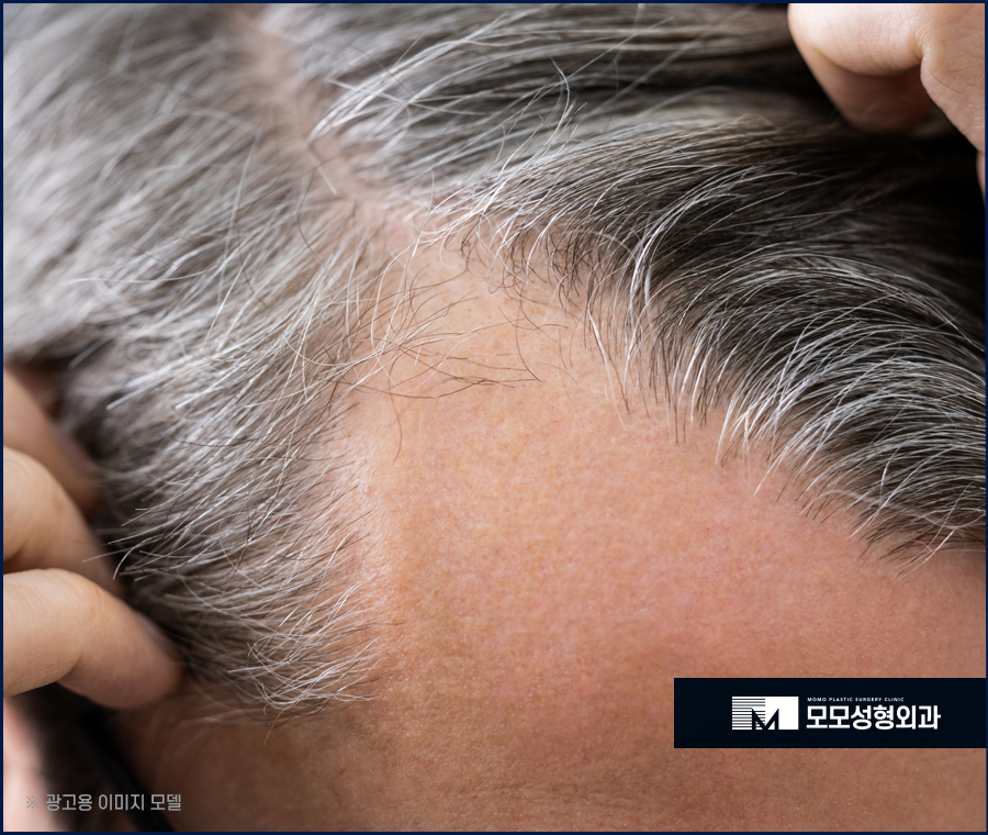 두피마사지법 증세에 효과적인 관련 이미지 3