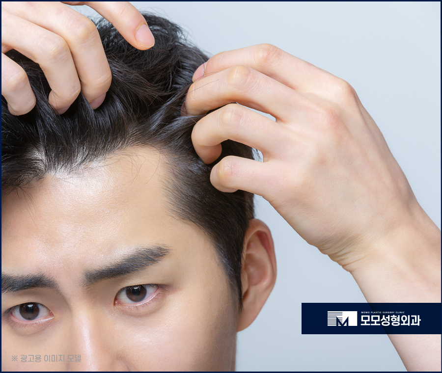 남자헤어라인모발이식 디자인까지 꼼꼼하게 고려하며 관련 이미지 2