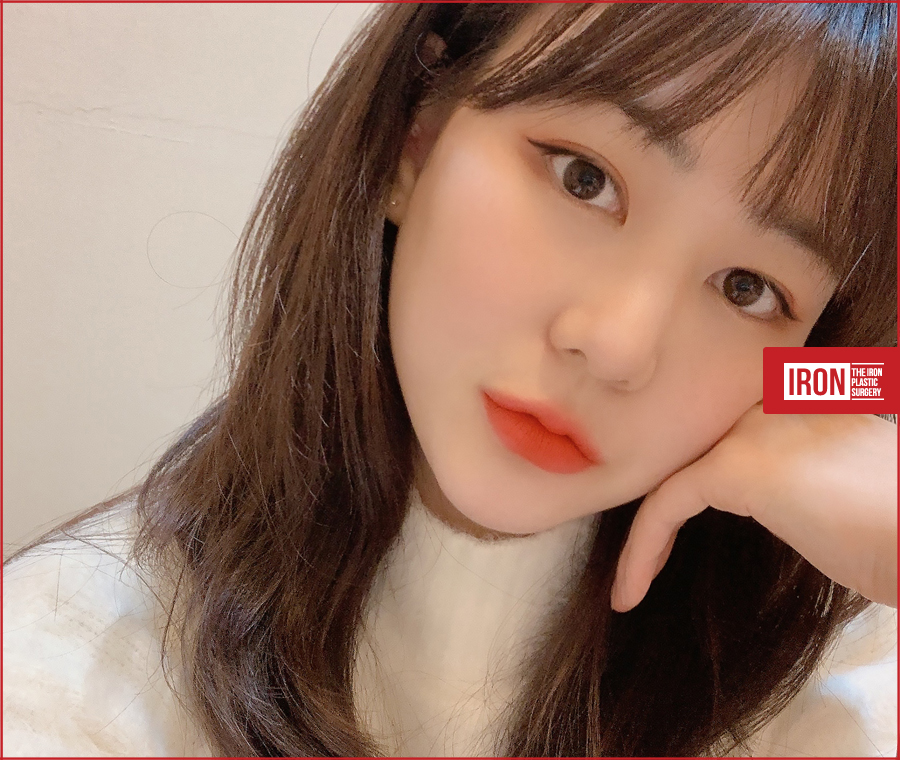쌍꺼풀아웃라인 화려한 변신을 통해 관련 이미지 2