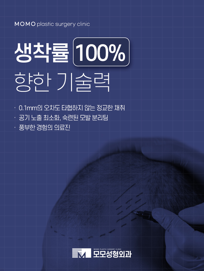 모발이식5000모 얼굴형까지 적절히 유념해서 관련 이미지 11
