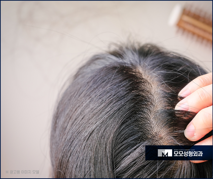 압구정탈모병원 방향과 모량까지 고려해서 관련 이미지 3