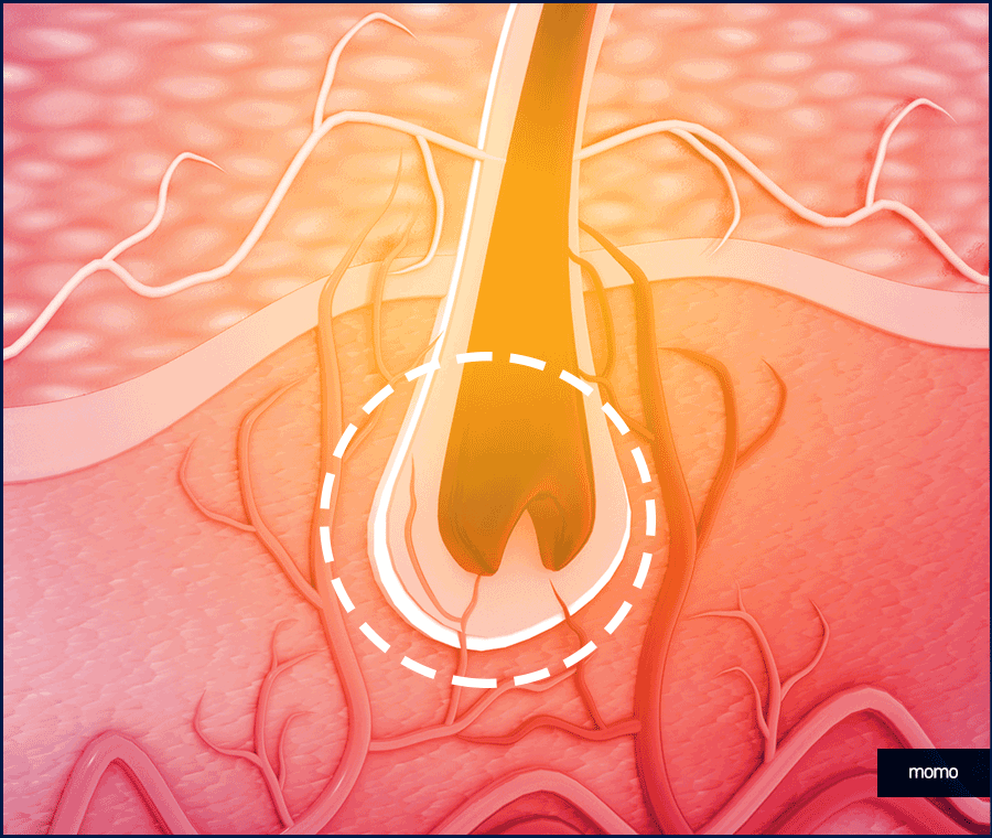 압구정모발이식 원하던 모습을 찾는 포인트 관련 이미지 6