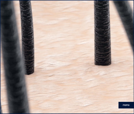 모발이식병원추천 선택 시 꼭 체크할 사항 3가지 관련 이미지 4