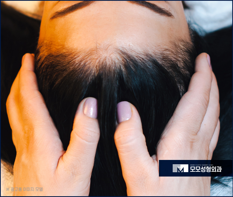 두피마사지법 증세에 효과적인 관련 이미지 7