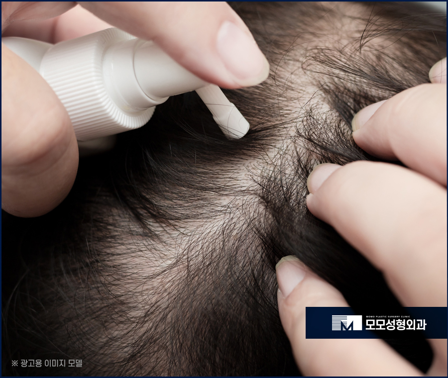 여자모발이식후기 다양하게 비교해 보아야만 관련 이미지 7
