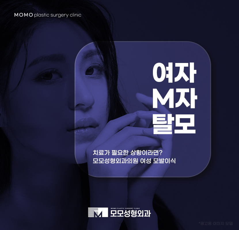 여자M자탈모치료 고민되는 상황에서는 관련 이미지 1