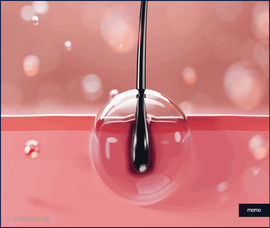 여자 가르마 탈모 모발이식으로 효과보려면? 관련 이미지 3