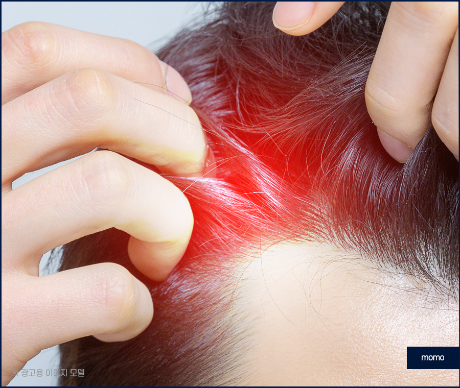 비절개 모발이식 비용 개인차를 고려해서 관련 이미지 3