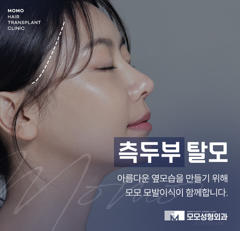 여자 측두부 탈모 아름다운 옆모습을 만드는 방법 관련 이미지 1