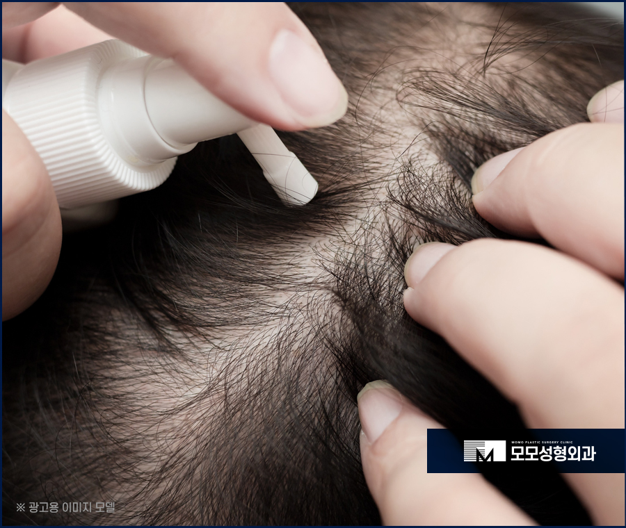 바르는탈모약 효과를 톡톡히 보길 원한다면 관련 이미지 5