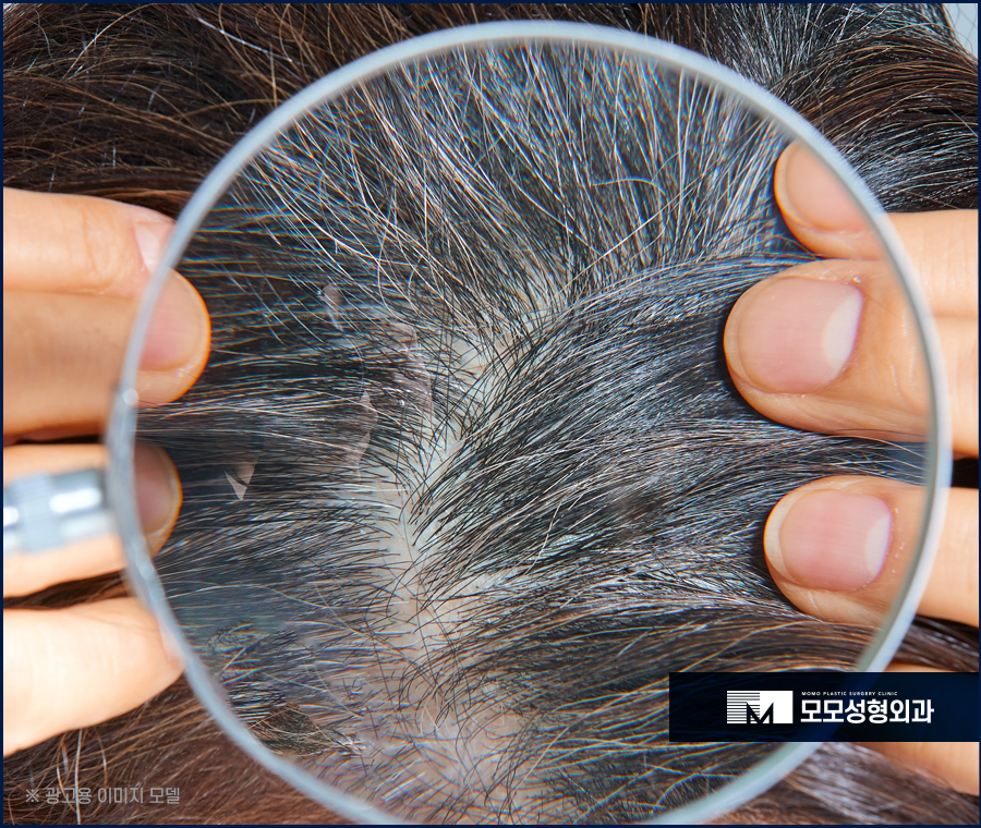 새치 흰머리 차이와 가볍게 잘라내야 하는 이유 관련 이미지 3