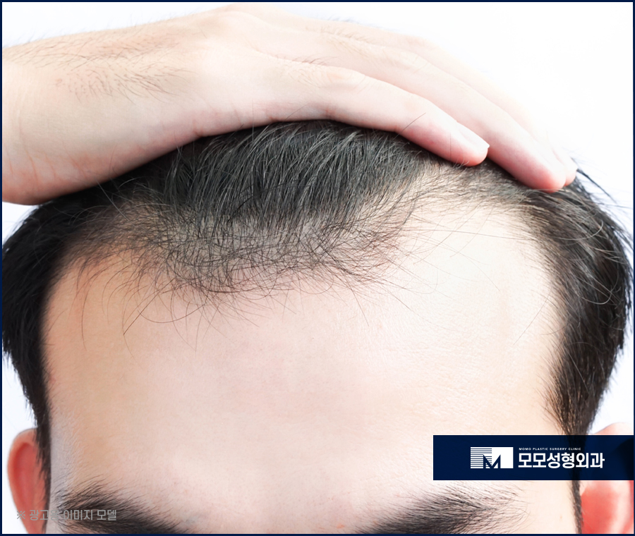 엠자이마 촘촘하게 채워 자연스럽게 보강하는 관련 이미지 2