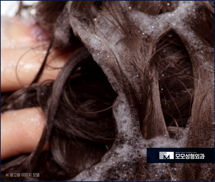 모발이식 1년이 지났을 때 경과가 좋으려면 관련 이미지 3