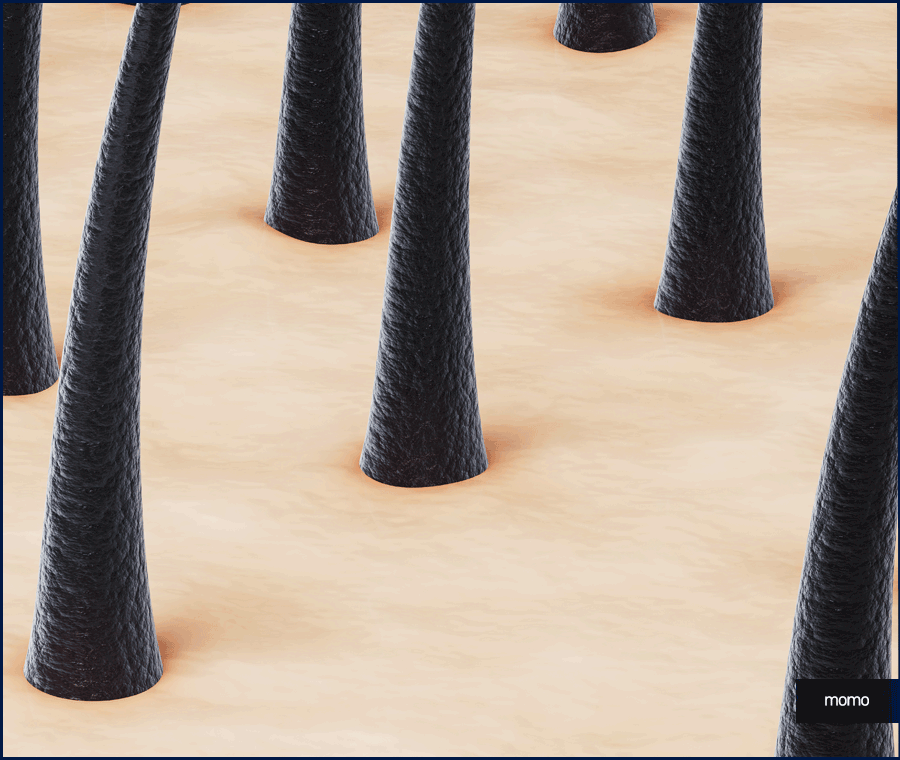 비절개모발이식가격 확인보다 중요한 점 관련 이미지 10