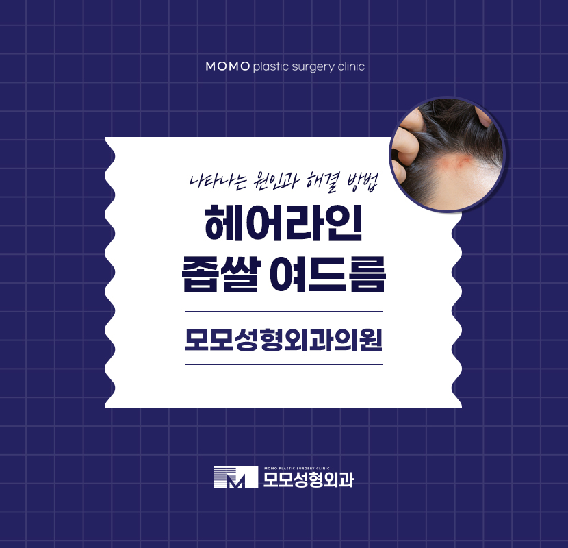 헤어라인좁쌀여드름 생성 원인과 해결법 관련 이미지 1