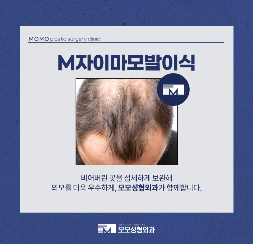 M자이마모발이식 빈 곳을 섬세하게 보완하며 관련 이미지 1