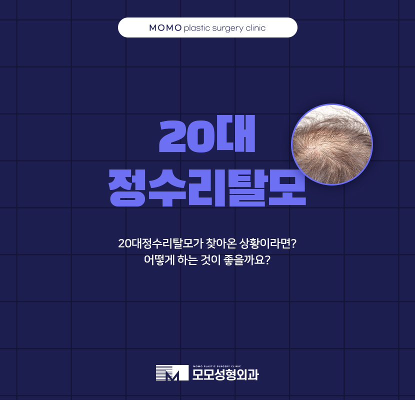 20대정수리탈모 찾아온 상황에서는 관련 이미지 1
