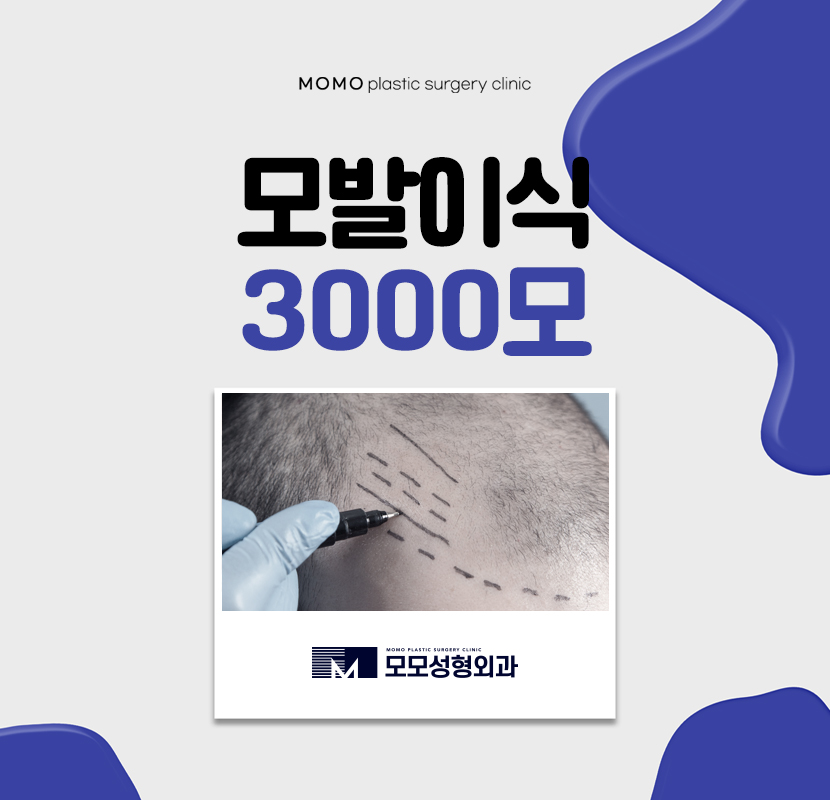 모발이식3000모 비용만 살피기 보단 관련 이미지 1