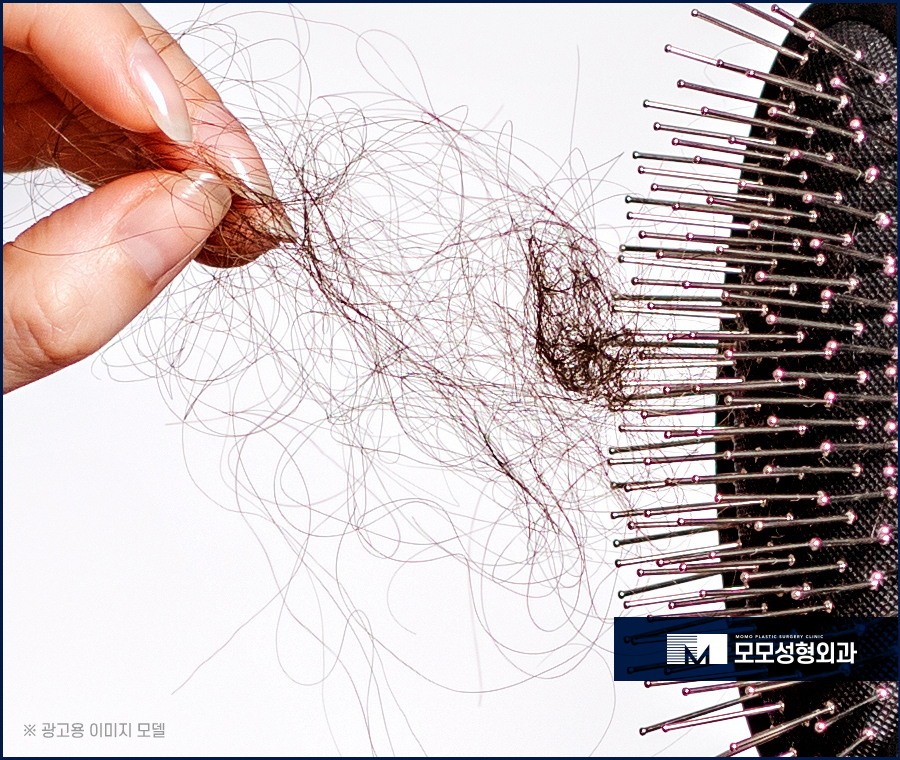신사역탈모병원 예후가 우수하려면 관련 이미지 2
