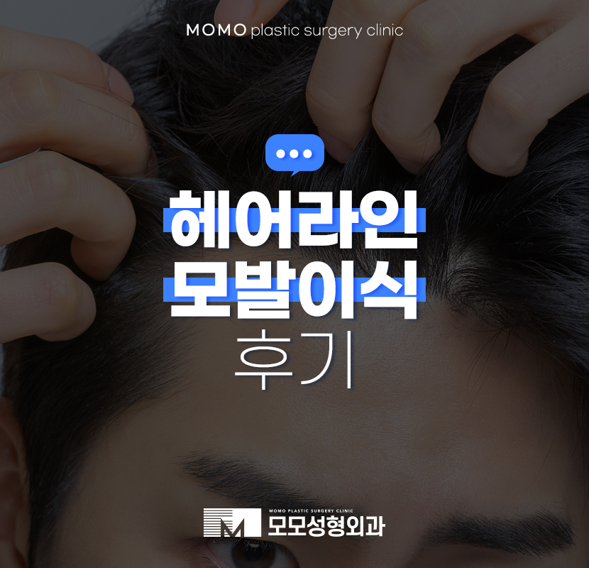 헤어라인모발이식후기 정교하게 개선을 관련 이미지 1