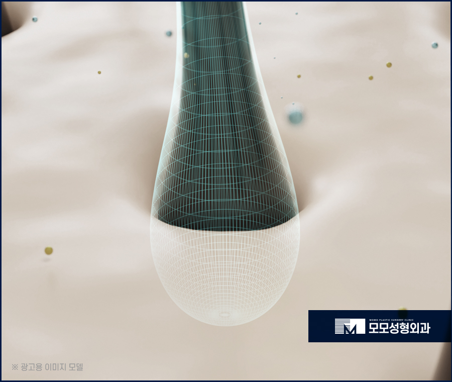 모발이식 6개월 차 변화와 유의할 점에 대해서 관련 이미지 5