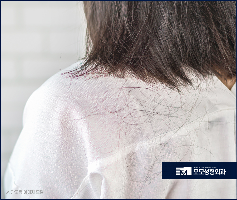 여성 옆머리 탈모 증상이 보여질 경우 해결 방법은 관련 이미지 2