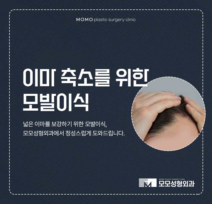 이마축소술 자연스럽게 채워가고 싶다면 관련 이미지 1